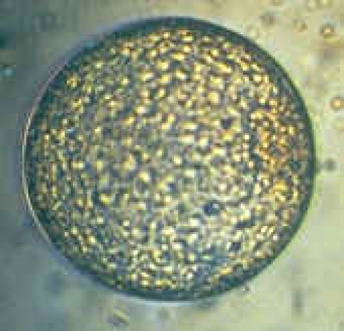 OPU-ICSI